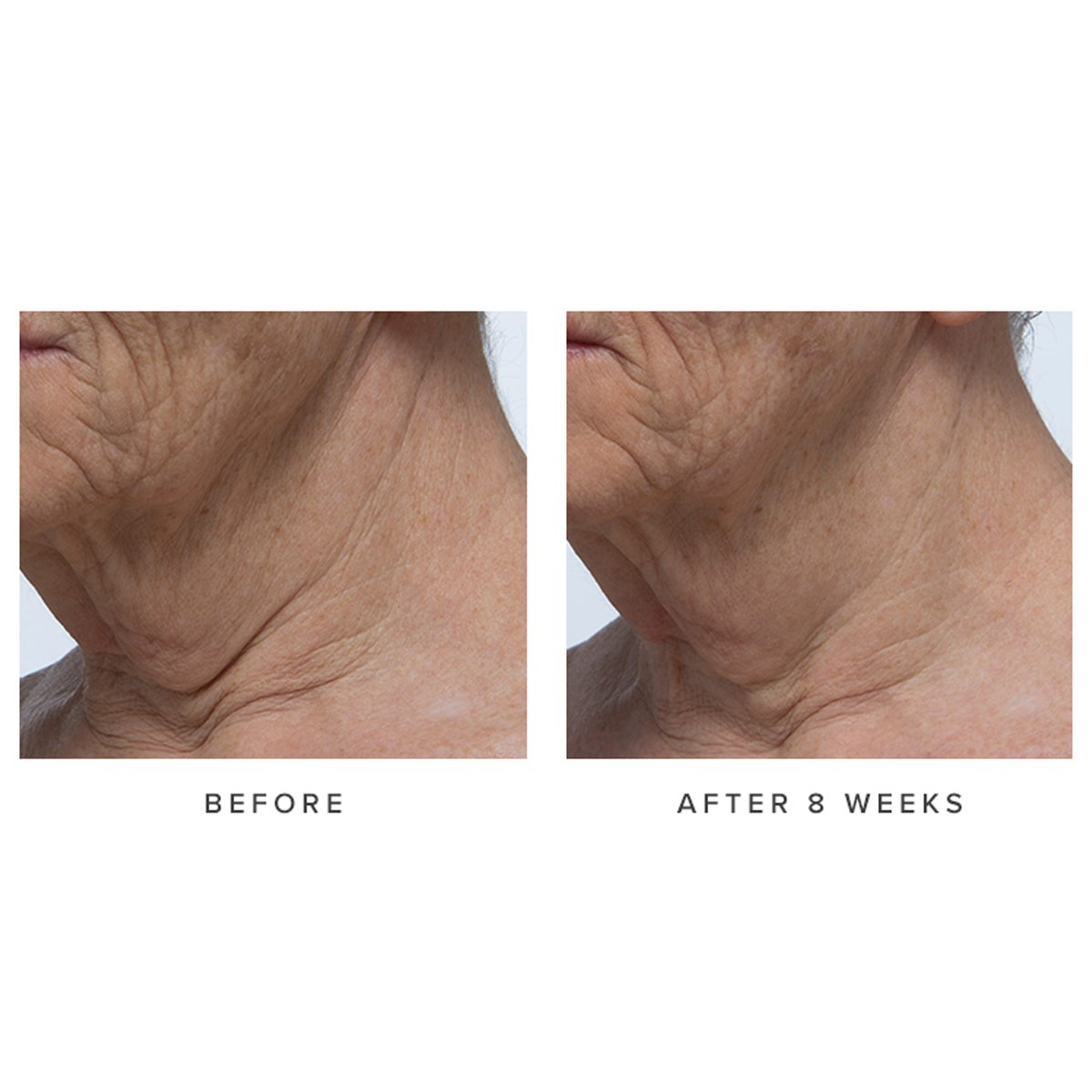 Ageless Revitalizing Neck Cream.