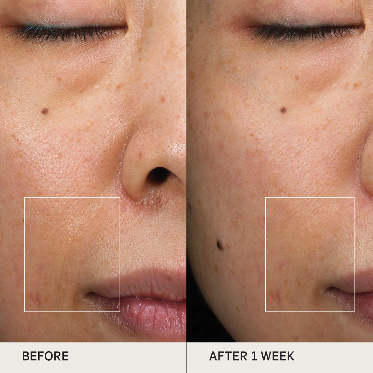 Before and after of skin using the Tatcha Essence for clinical tests
