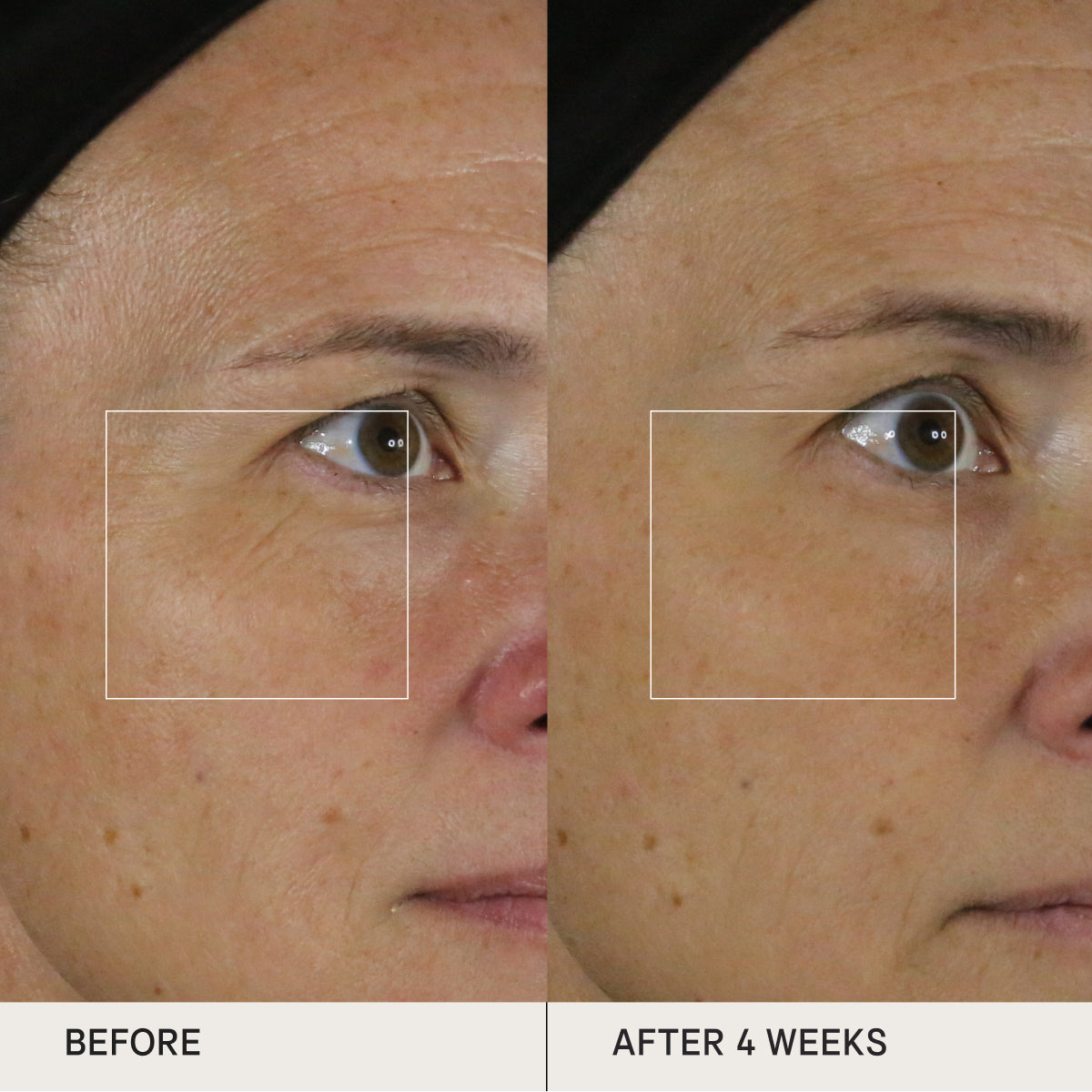 Before and after of skin using the Tatcha Silk Serum for clinical tests