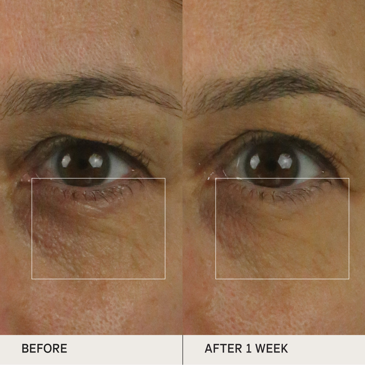 Before and after of skin under the eyes using the Tatcha Brightening Eye Cream for clinical tests