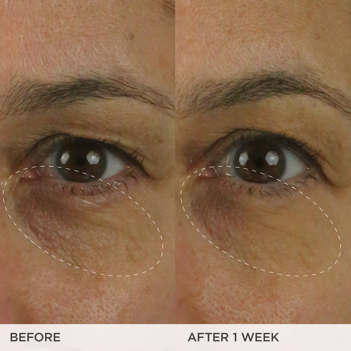 The Brightening Eye Cream