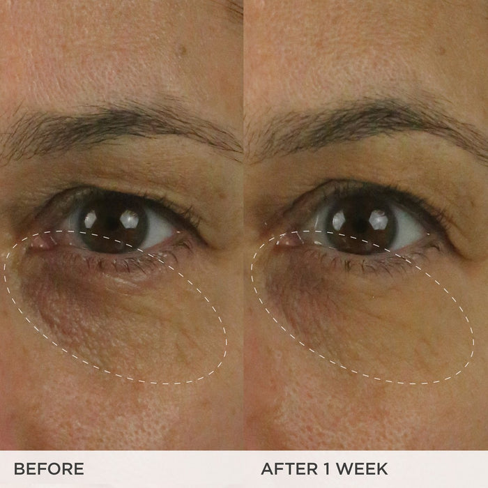 The Brightening Eye Cream | Tatcha