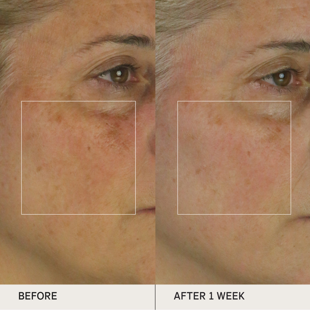 Before and after of skin using the Tatcha Brightening Serum for clinical tests