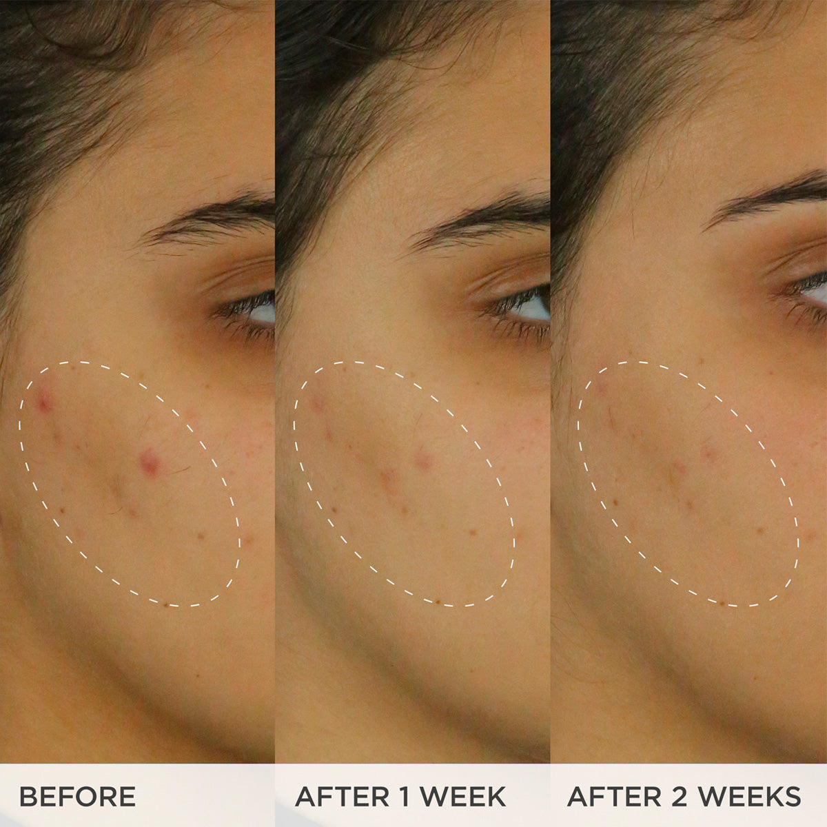 Brightening Serum: Before, After 1 week, After 2 weens