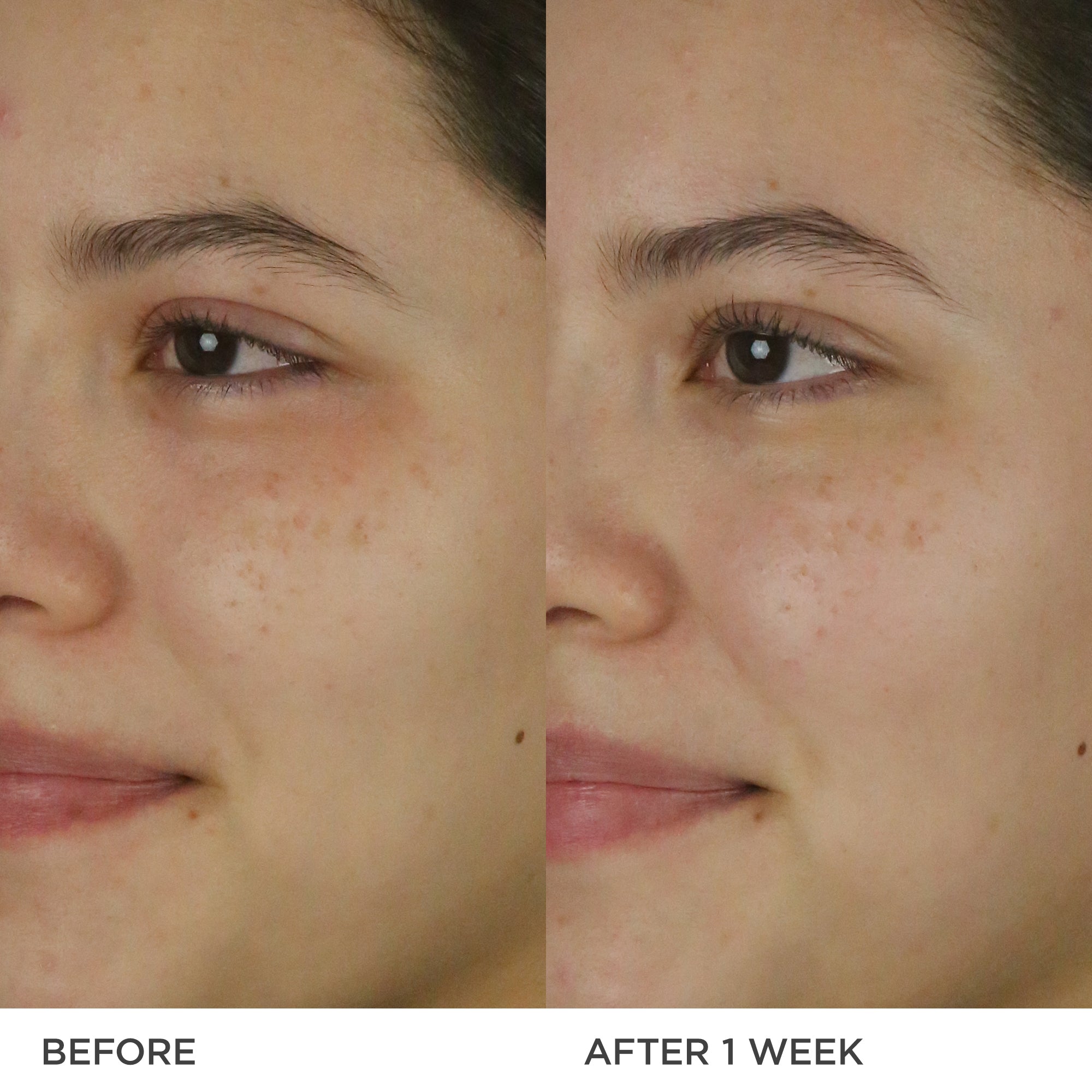 The Dewy Milk Moisturizer Before & After
