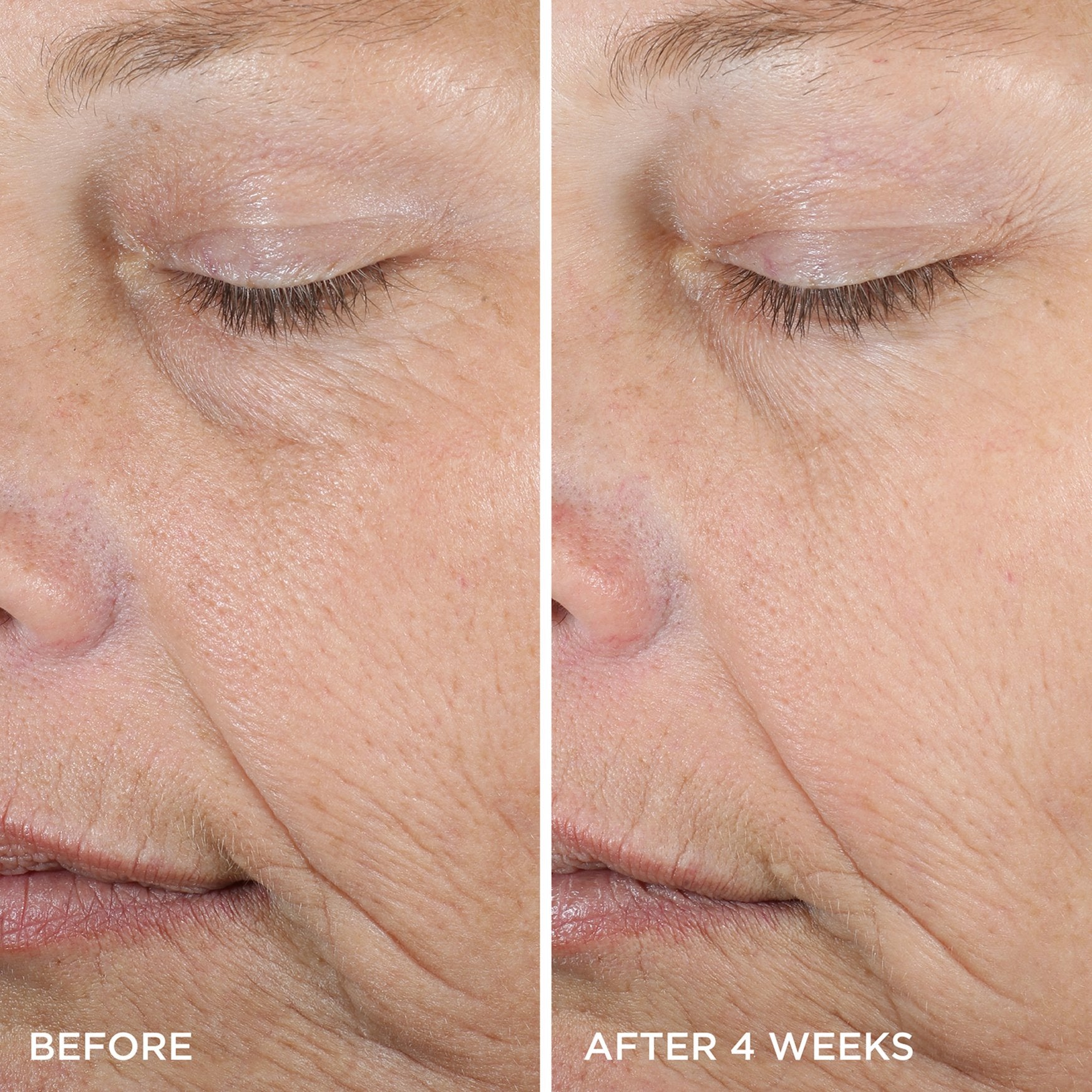 The Dewy Serum Before & After