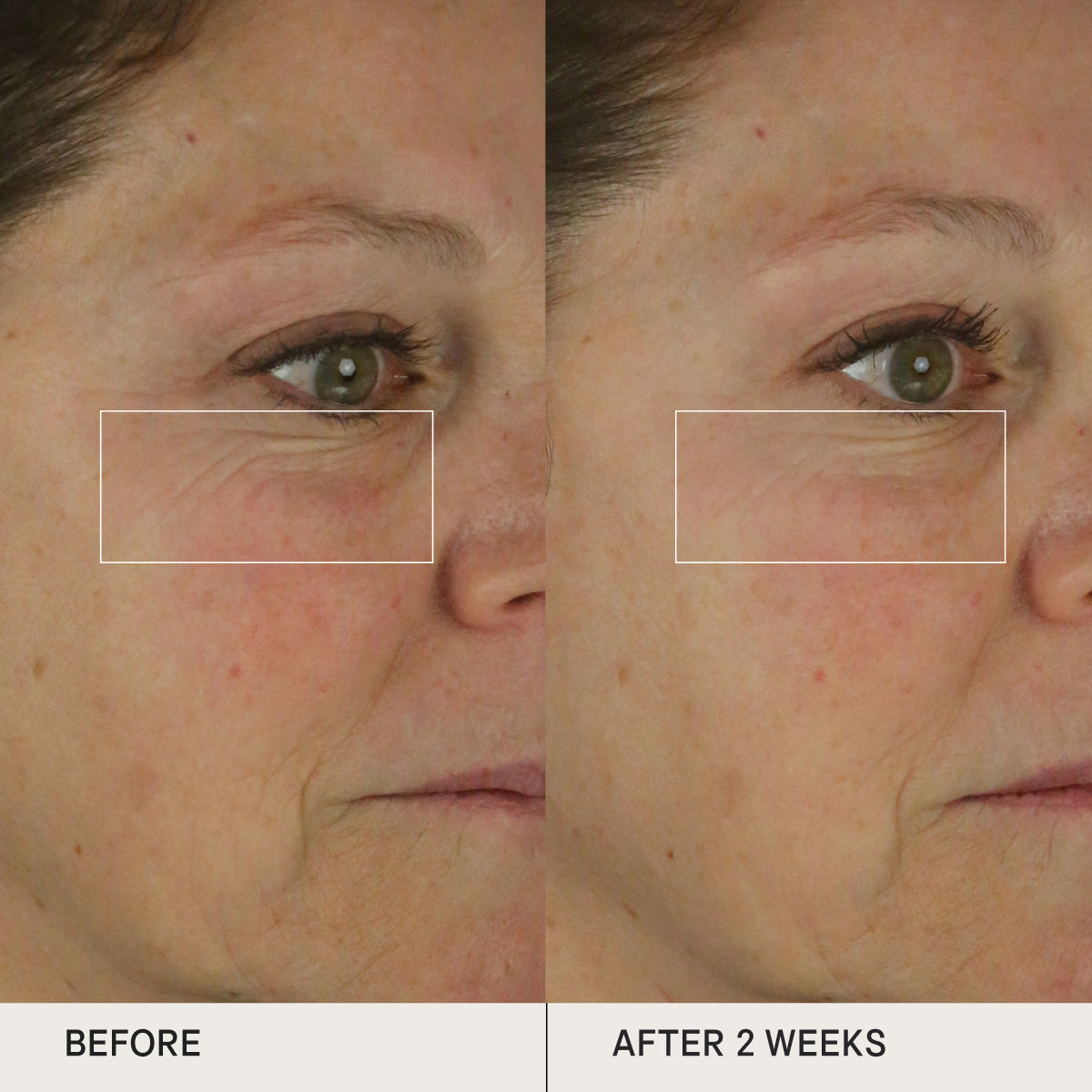 Before and after of skin using the Tatcha Dewy Skin Cream for clinical tests