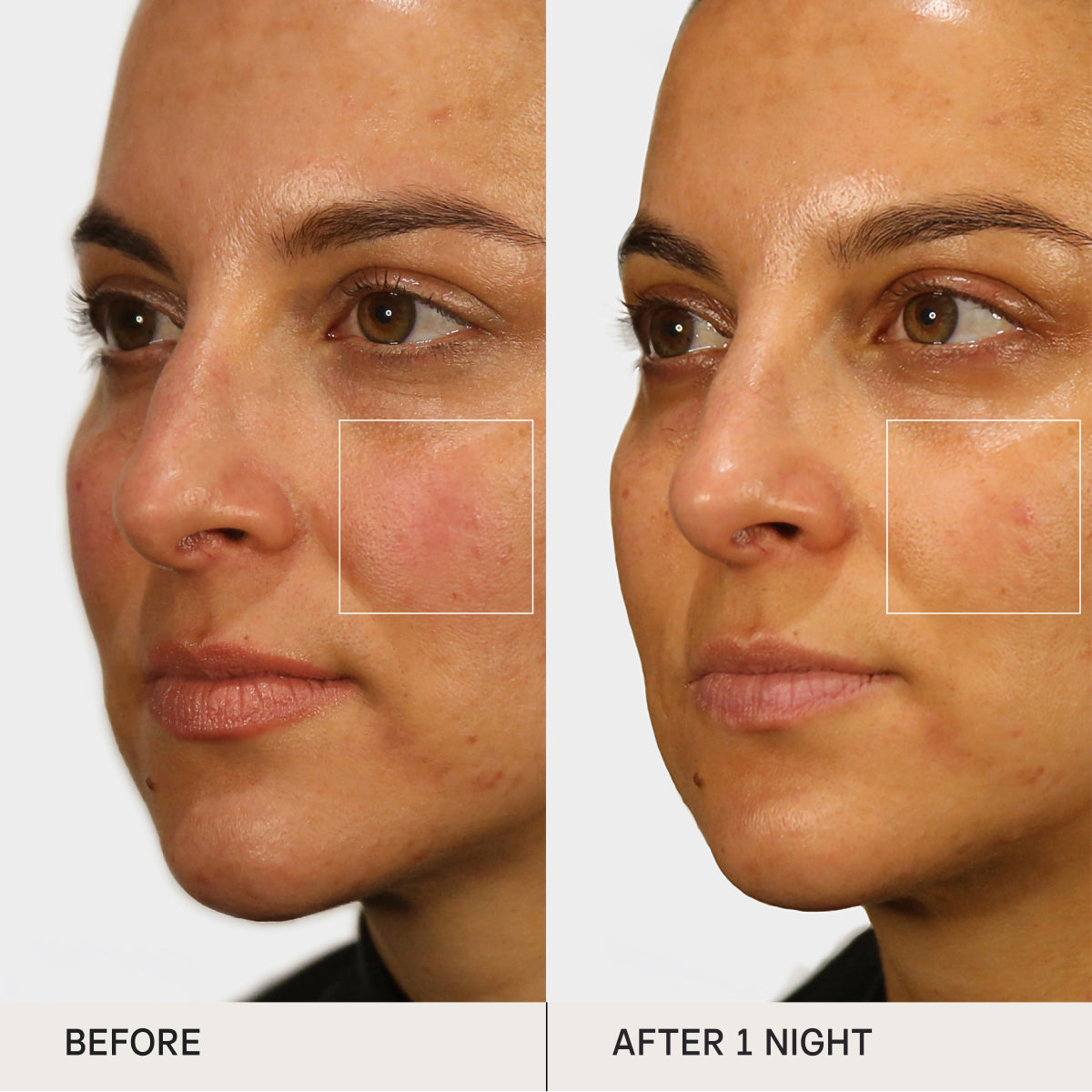 Before and after of skin using the Tatcha Indigo Overnight Repair for clinical tests