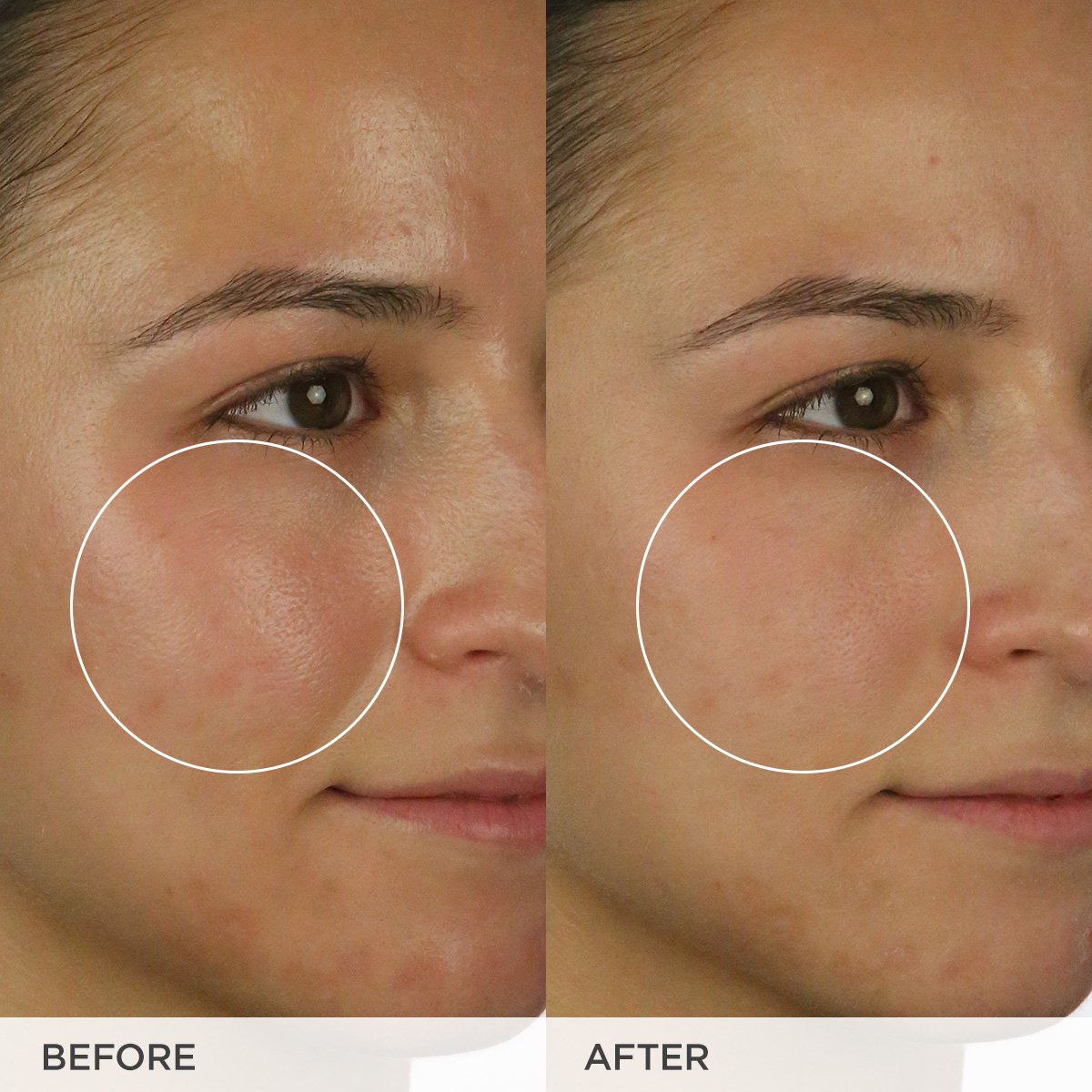 The Matcha Cleanse Before & After