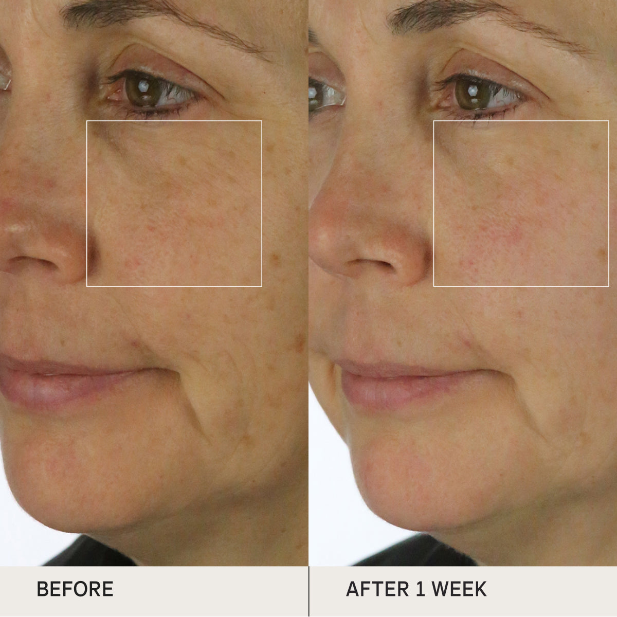 Before and after of skin using the Tatcha Silk Cream for clinical tests