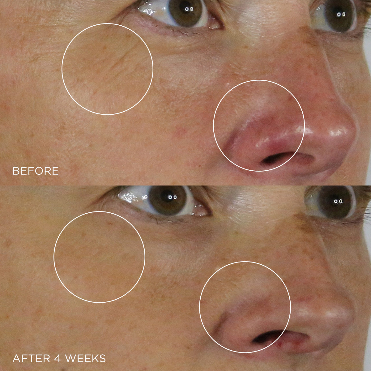 The Silk Serum Before & After