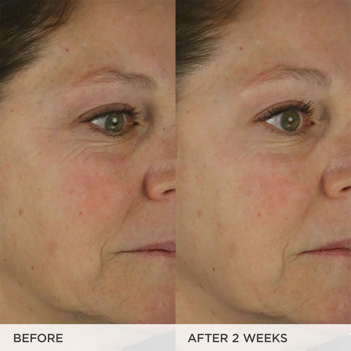 The Dewy Skin Cream Before & After