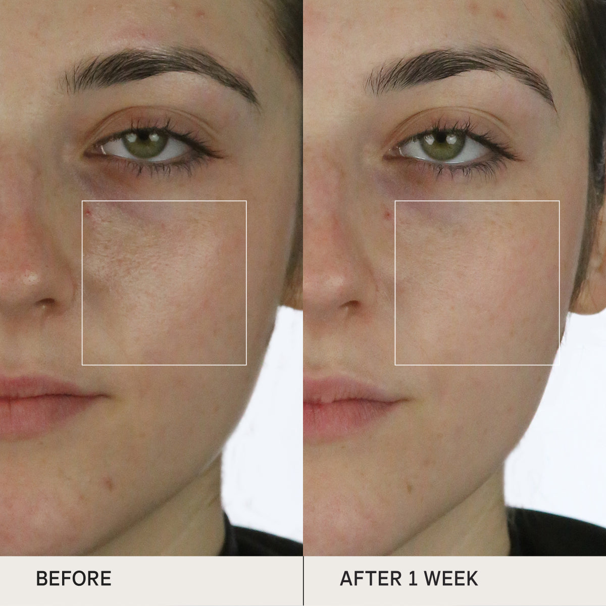 Before and after of skin using the Tatcha Water Cream for clinical tests