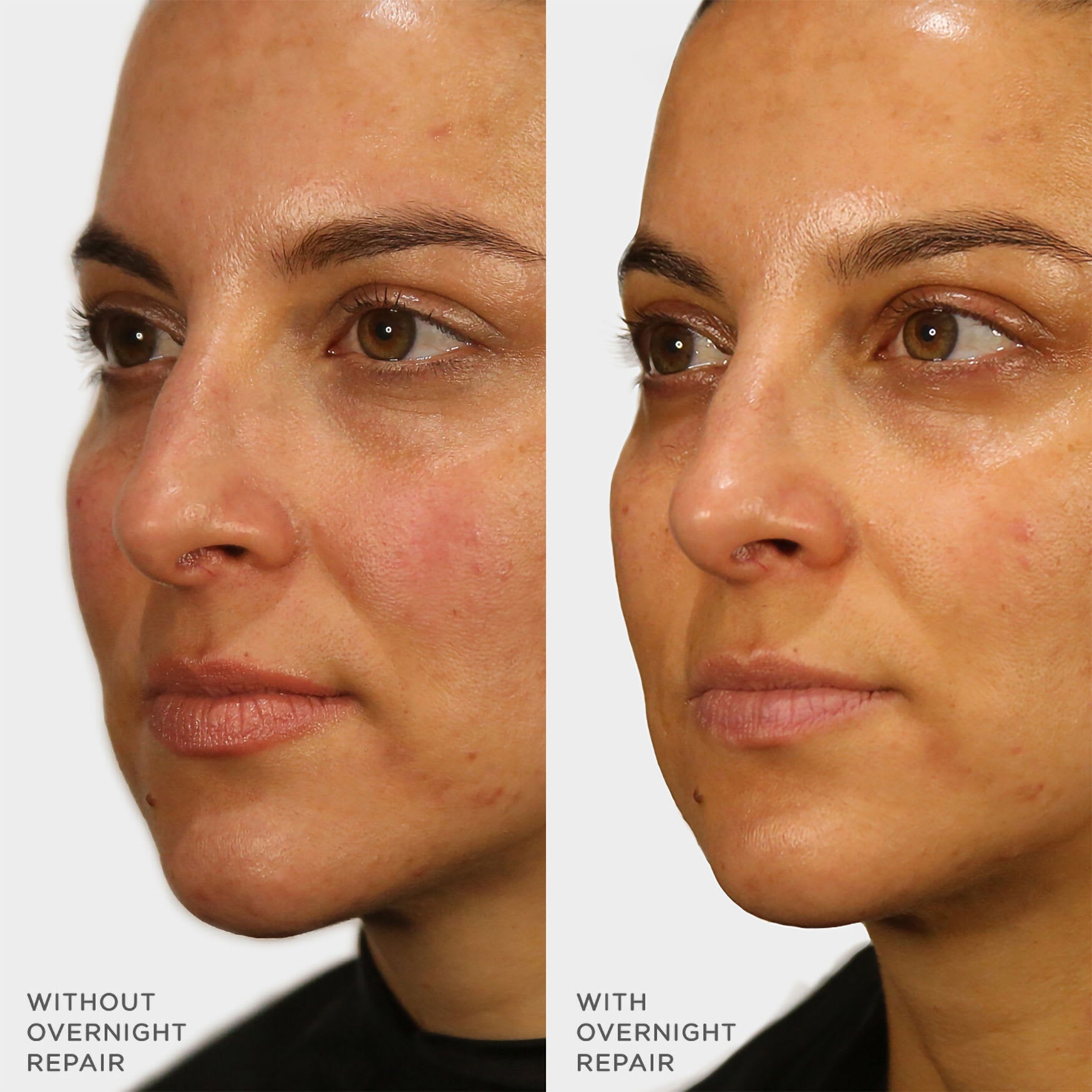 Indigo Overnight Repair Before & After